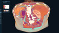 3D Organon Frame Grabs 3