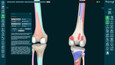 3D Organon Snaps 6